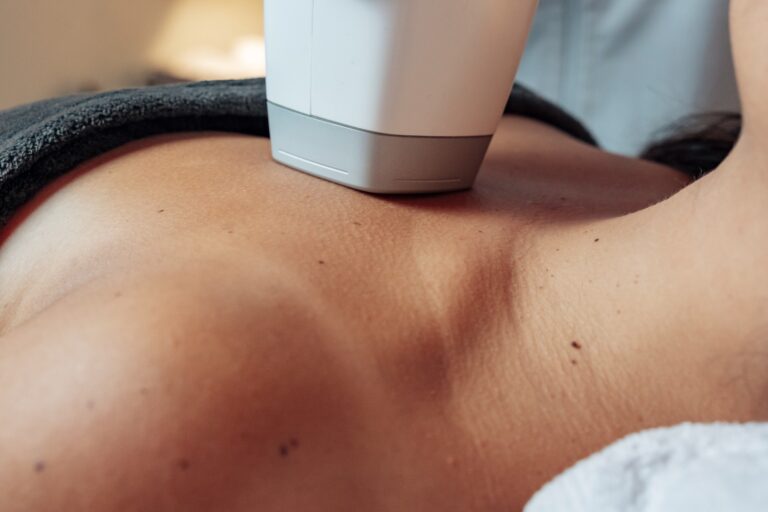 EpiLab diode laser • gezicht